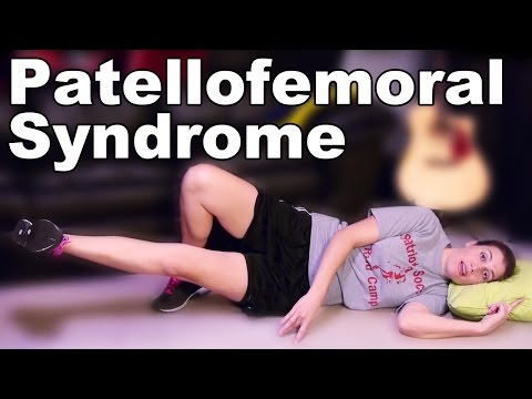 how to treat patellofemoral pain syndrome pfps