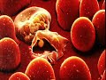 Mapping Travel Medicine