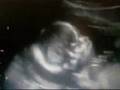 16week Ultrasound Scan