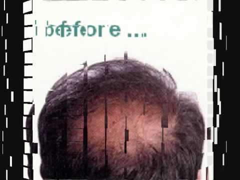 how to grow new hair follicles