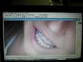 Photo Retouching tutorial for Photofiltre!