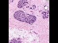 Shotgun Histology Inactive Breast