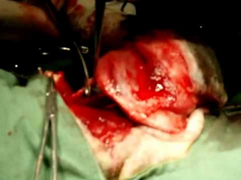 Amputação de Membro Torácico em Felino / Amputation of the cat forelimb