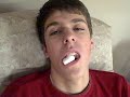 Weston and Jakob Wisdom Teeth  (14).AVI