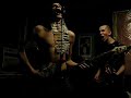 The Kidney Stones - Running With Sissors