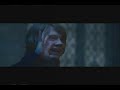 Ron Weasley is on fire