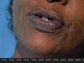 Memoria Ativa 9 - UTI Brasil
