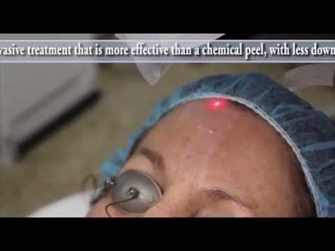 how to treat hyperpigmentation