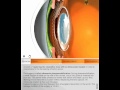 Cataract 3D: Quantel Medical