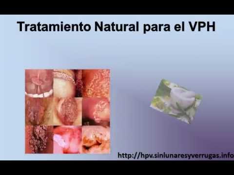 Los ungüentos en las farmacias de varikoza