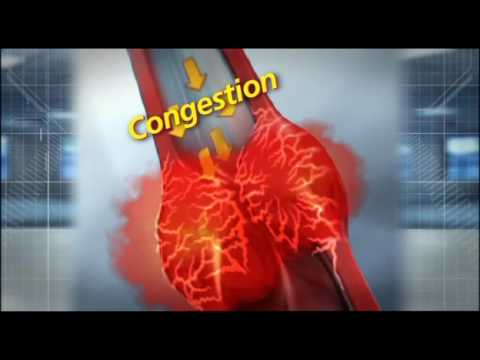 how to relieve sinus pain uk
