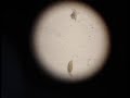 Creepy Crawlies