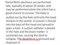 videos de Obama may lose 20 million voters over radical abortion views