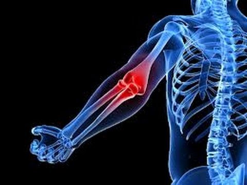 how to relieve tricep pain