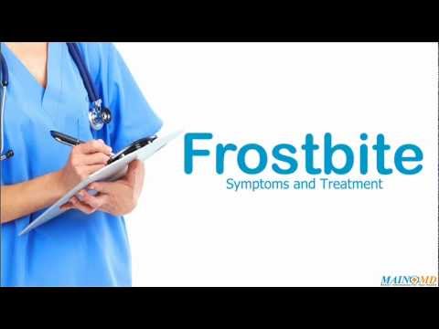how to treat frostbite on face