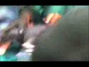 Natural Final Vaginal Stage Labor Childbirth - Episiotomy-B