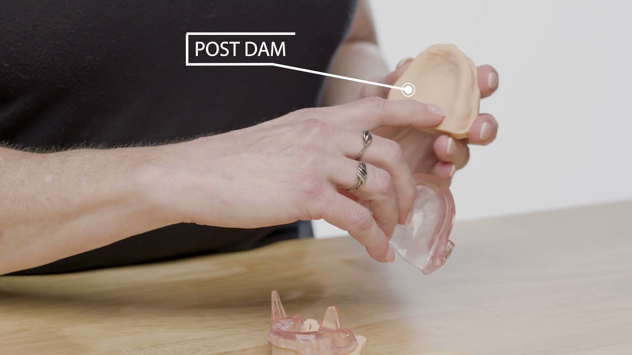 SomnoMed Edentulous Device