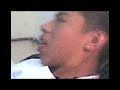 Perforacion de lengua Perforacion de lengua