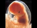 Respuestas a preguntas abortistas parte 2