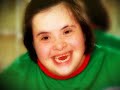 Down syndrome:&nbsp;S�ndrome de Down: Poema ''Los que no danzan'' 