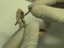 part-2-nobel-guided-implantscal-prosthesis-stumpel-dds.html