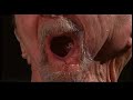 Anti Smoking PSA_Howard Singer - \"Cancer Cures Smoking\" Anti Smoking PSA_Howard Singer - \"Cancer Cures Smoking\"