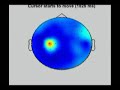 Brain Computer Interfaces