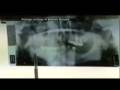 videos de Martin Kepa (5 08)   Video   tvnz.co.nz.rm Close Up