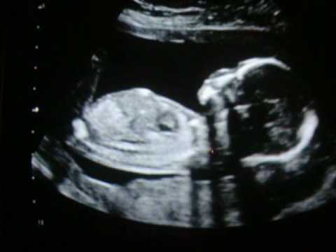 PART 1 :16 weeks 1 day Ultrasound..IT’S A GIRL!!!!