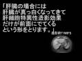 EOBプリモビストMRIのはじめ方、秘訣 EOB Primovist MRI