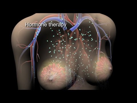how to cure breast cancer
