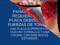 FRACTURA MANDIBULAR-OSTEOSINTESIS