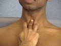 Tracheal Deviation