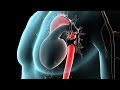 Anatomy of the Aorta