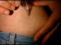 injection