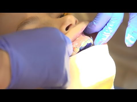 Kieferorthopädie: Wie sinnvoll sind Zahnspangen wirkl ...