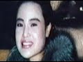 woman disfigured by cooking oil woman disfigured by cooking oil