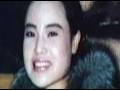 woman disfigured by cooking oil