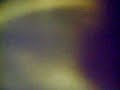 Si es que no se puede beber tanto...