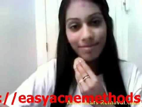 How Did I Get Rid of Acne Scar Naturally in 3 Days !