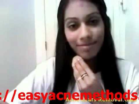 how to remove acne scars fast