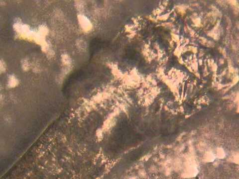 how to get rid of d. folliculorum
