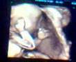 Mi hija en su barriga