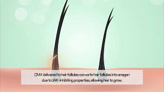 video thumbnail ANACELL Hair Ampoule For Scalp (1ml X 30EA / 1BOX) - Scalp Self Homecare, Voluming, Hair Loss Thicke youtube