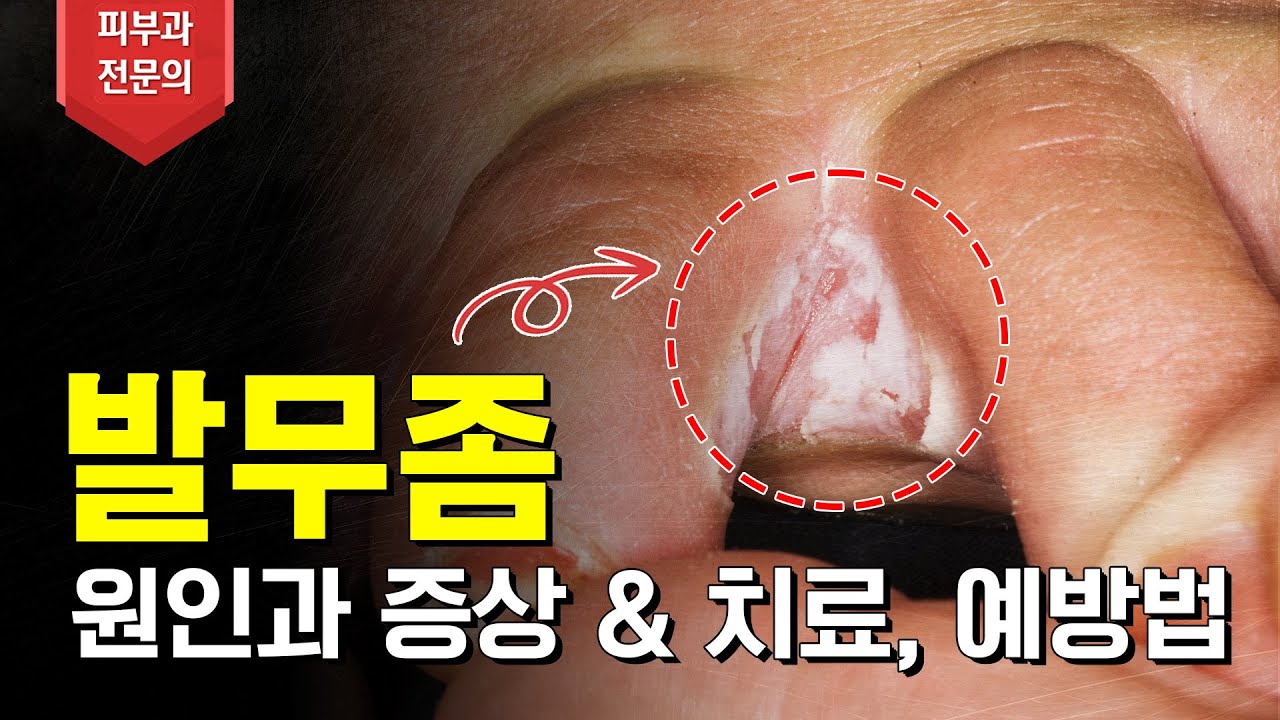 연세스타피부과 TV