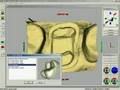 CEREC Crown Software