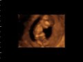 Baby at 13 weeks in 4D Baby at 13 weeks in 4D