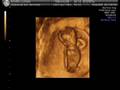 Bebe 13 semanas - parte 2