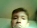 videos de Muttermal entfernen.3gp