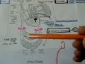 acute heart failure 3